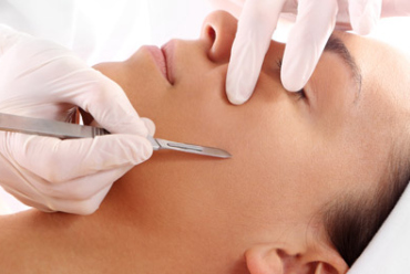 DERMAPLANING